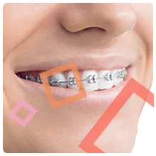 Oral B best ever clean with revolutionay Magnetic iO Technology