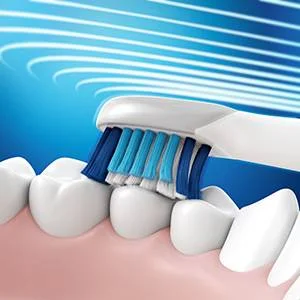 Oral-B Aufsteckbürste, die Zähne reinigt, wobei blaue Borsten und blaue Lichtstrahlen die Reinigungstechnologie hervorheben.