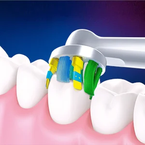 Oral-B Zahnbürstenkopf reinigt Zähne mit verschiedenen farbigen Borsten, die unterschiedliche Bereiche des Zahns erreichen.