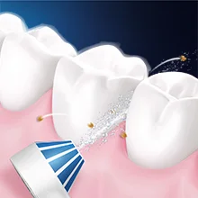 Oral-B Aufsteckbürste, die Plaque zwischen den Zähnen entfernt, dargestellt durch kleine Partikel, die von der Bürste weggespült werden.