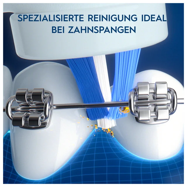 Oral-B iO My Way Elektrische Zahnbürste ab 10 Jahren, 4 Putzmodi, extra Aufsteckbürste für Zahnspange, 1 Reiseetui, ocean blue